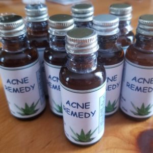 Acne Remedy