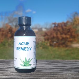 Acne Remedy